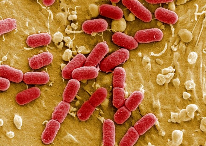 Un informe sobre resistencia antimicrobiana reveló que 25 mil personas mueren cada año en la UE a causa de las superbacterias (Reuetrs)