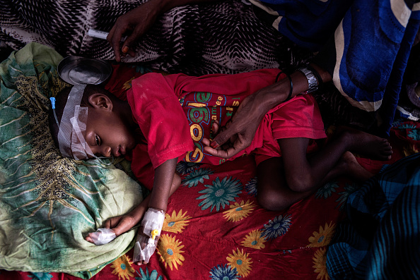 Un joven sufre desnutrición en la sala de un hospital en Garowe, Somalia. (Getty Images)