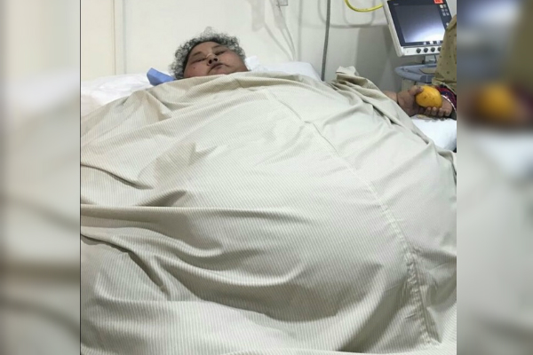 La egipcia Eman Ahmed Abd El Aty sufre de edemas linfáticos severos, retención de líquido, diabetes, hipertensión e hipotiroidismo, padece de gota y problemas graves en los pulmones (Twitter @thekavitasharma)