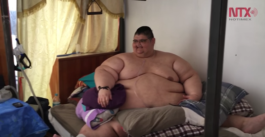 hombre más obeso del mundo, sobrepeso, obesidad