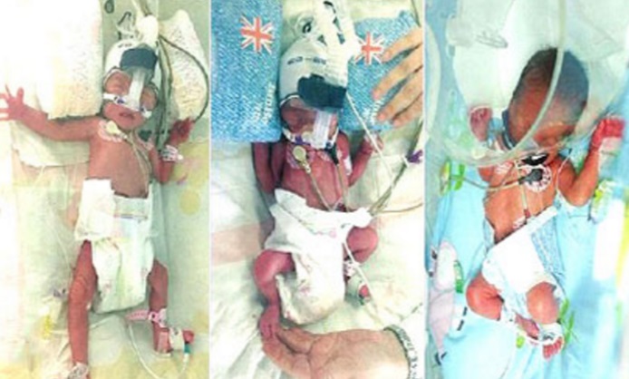Una mujer embarazada de trillizos dejó a médicos en China desconcertados (Foto: vanguardngr.com)