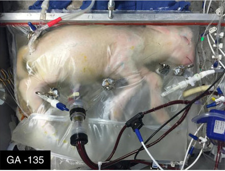 Un cordero prematuro es mantenido con vida mediante un útero artificial (nature.com)