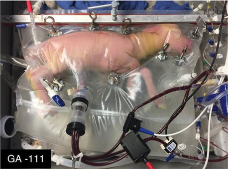 Un cordero prematuro es mantenido con vida mediante un útero artificial (nature.com)