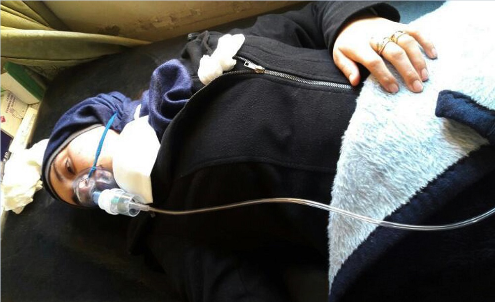 Sobreviviente del ataque químico en la localidad de Khan Sheikhoun, en Siria; autoridades turcas confirman que se usó gas sarín (AP)