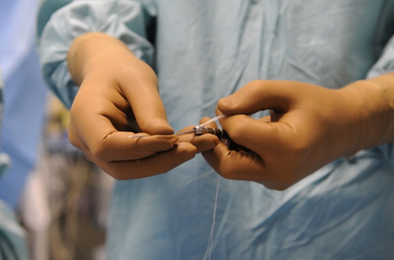 El momento de una cirugía plástica (Getty Images)