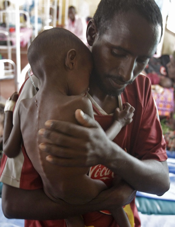 ONU alerta que 40% de la población de Sudán del Sur está en peligro de hambruna (AP)