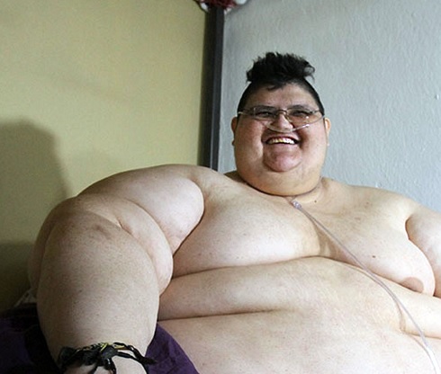 Juan Pedro Franco, el hombre más obeso del mundo, que llegó a pesar 595 kilogramos (Notimex)