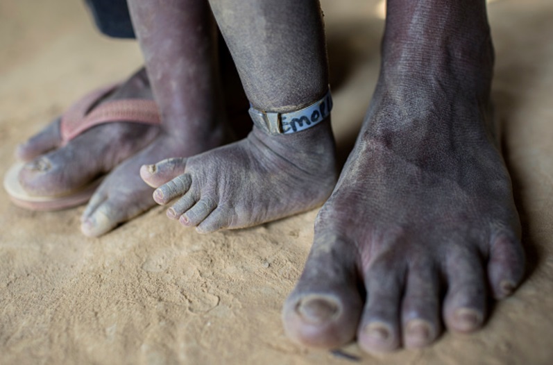 ONU prevé que 550 millones de personas permanezcan en la pobreza extrema (Getty Images)
