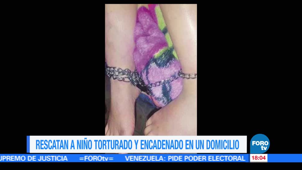 Ciudad de México, niño de cinco años, signos de tortura, encadenado