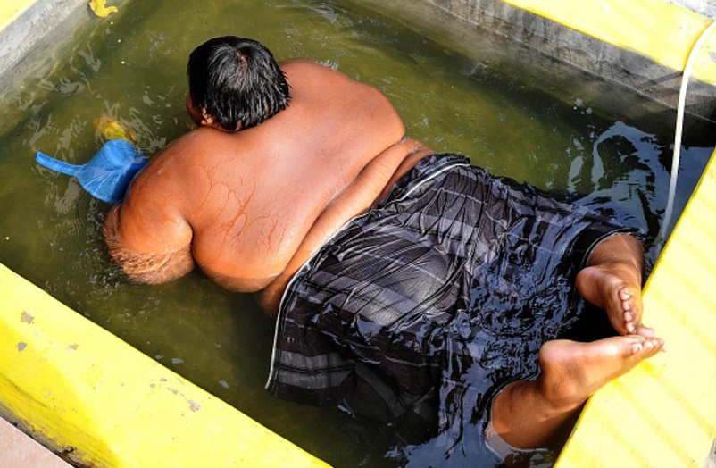 Unos 2,200 millones de personas sufren sobrepeso u obesidad en el mundo (Getty Images)
