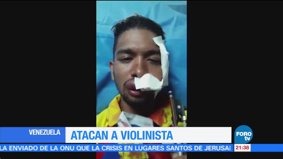 Atacan Violinista Opositor Venezuela Noticias Forotv