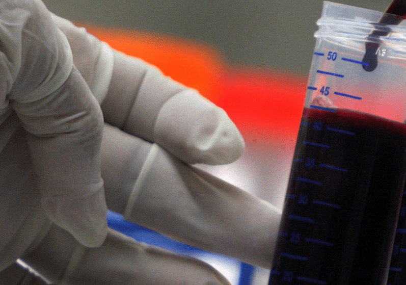 Científico maneja una muestra de sangre