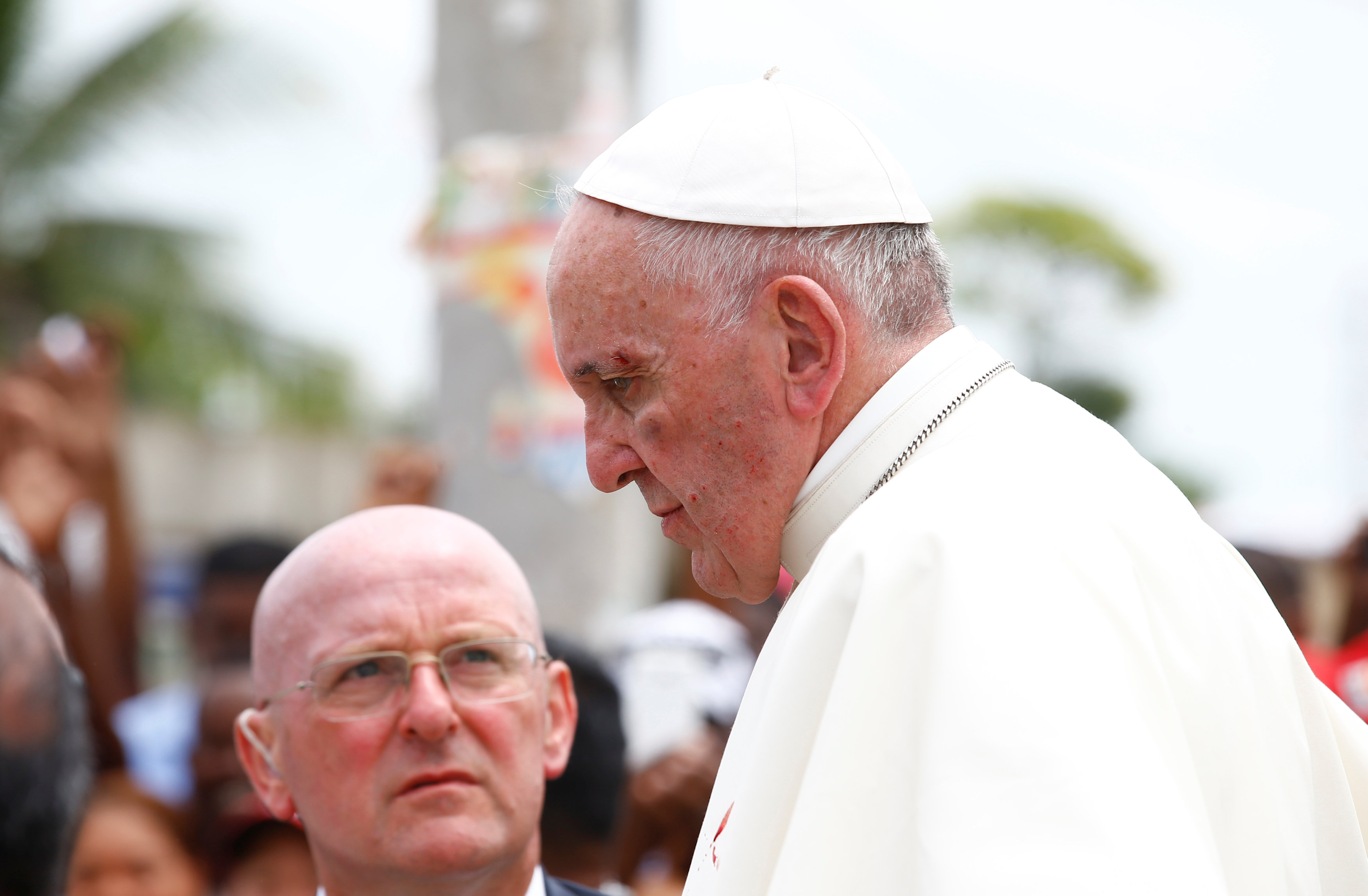 Papa sufre golpe en cara al intentar saludar a niño en Cartagena