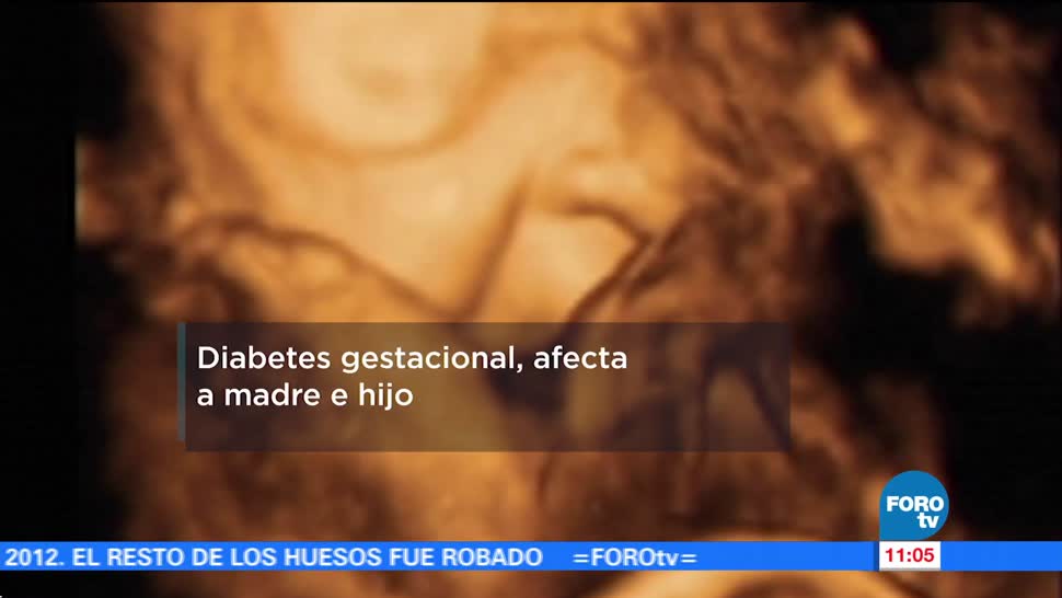 Investigadores Unam Diabetes Gestacional Afecta Bebés