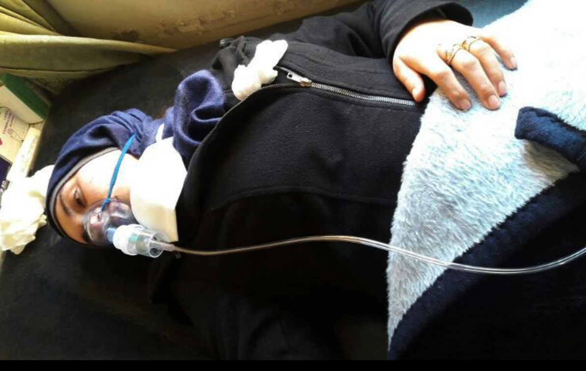 Mujer herida por ataque con gas sarín en Siria