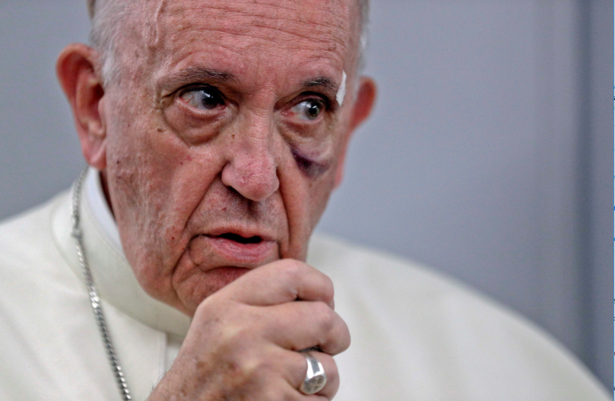 El papa Francisco sufrió un golpe en la cara en Colombia