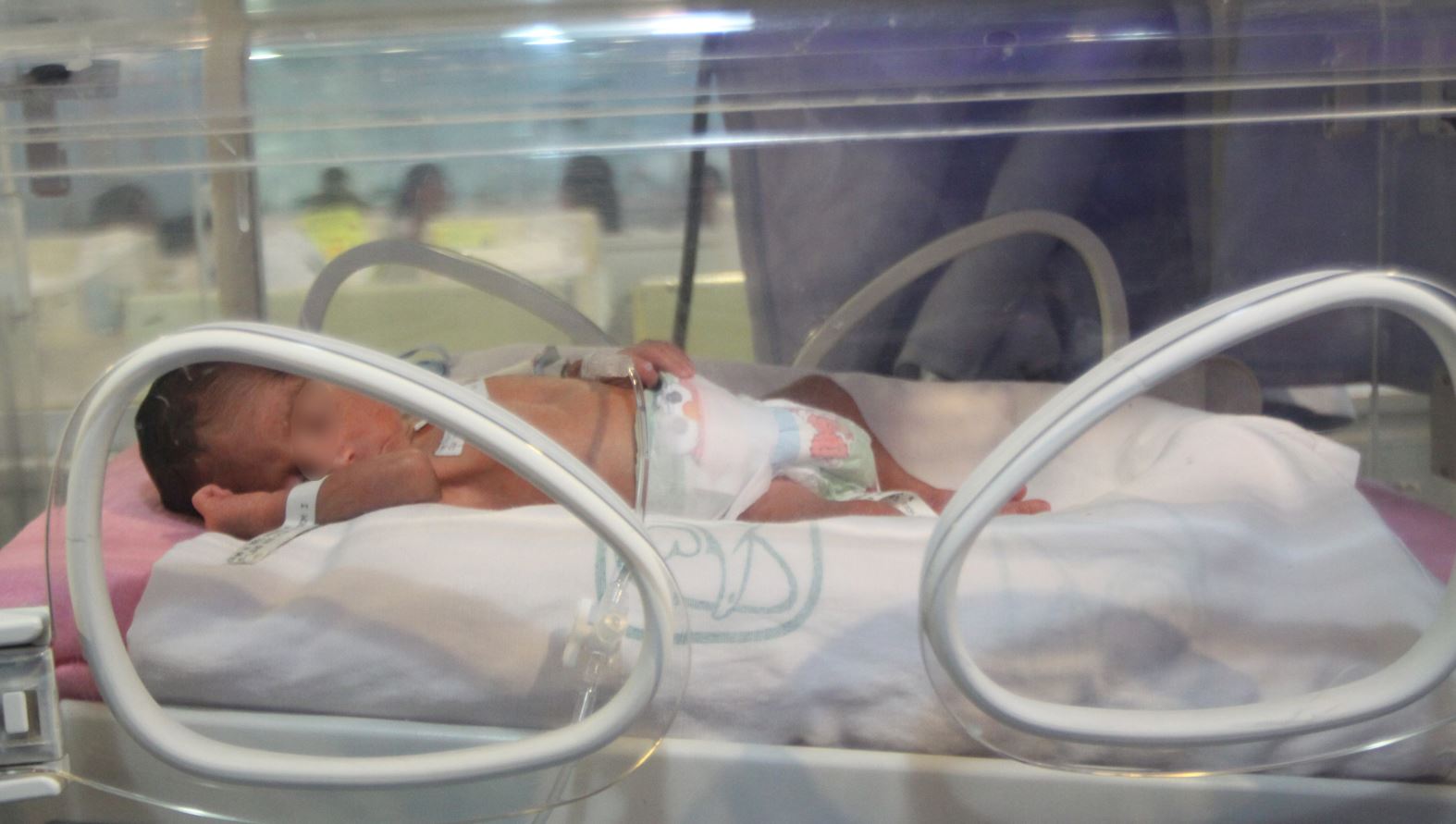 bebes prematuros recibe atencion con oxigeno