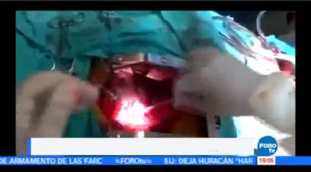 Difunden Video Médicos Cirugía Corazón Abierto Durante Sismo