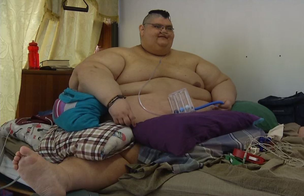 El hombre más gordo del mundo se somete a cirugía en Guadalajara