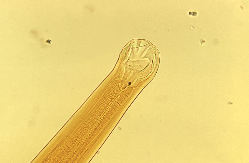 larva-migrans-cutánea