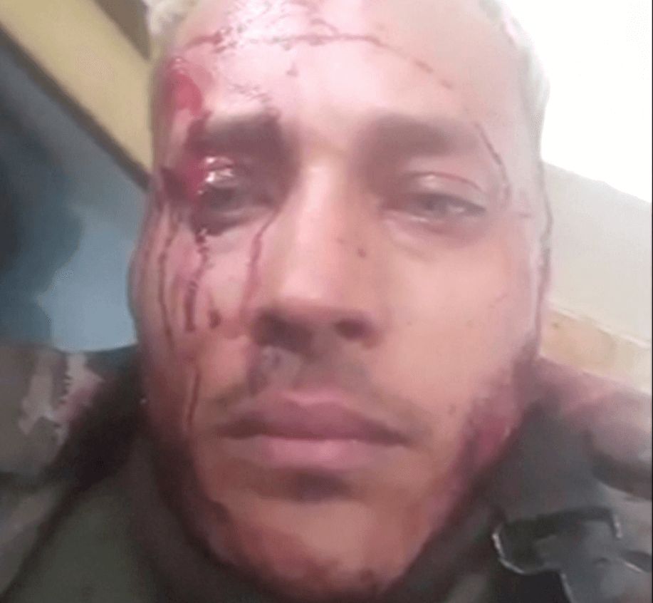 El policía rebelde venezolano Óscar Pérez resultó herido durante operativo
