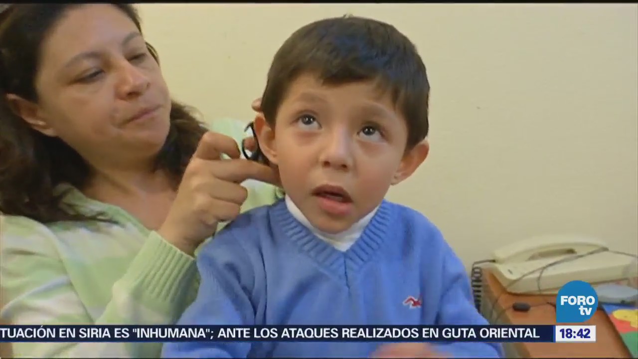 Implantes para niños sordos