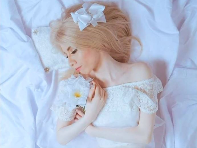 Una de cada 17 mil personas en el mundo nace con albinismo