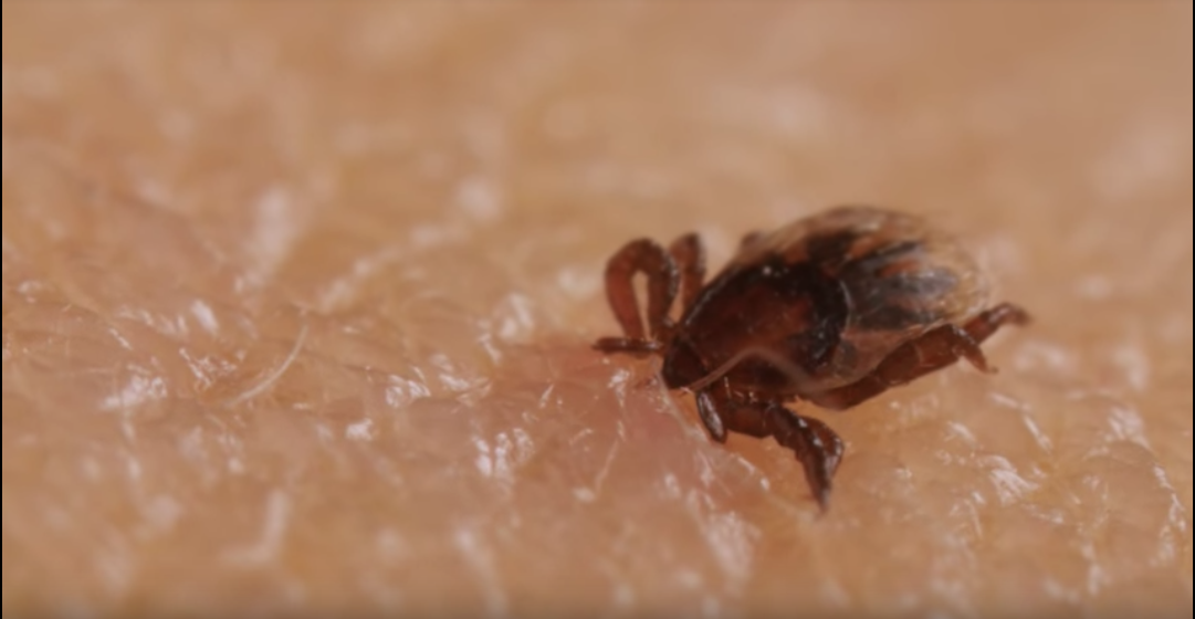 Video: Así escarban las garrapatas en la piel humana
