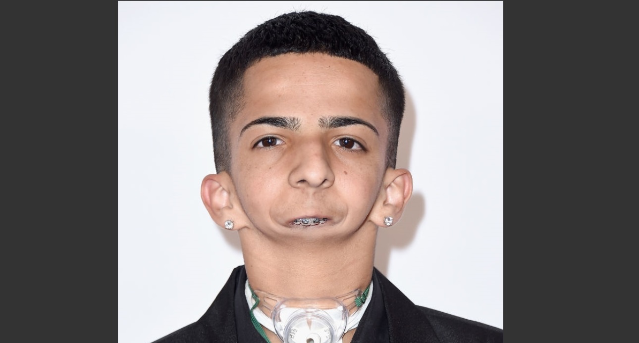 Isaiah Acosta, joven sin mandíbula que se comunica a través del rap