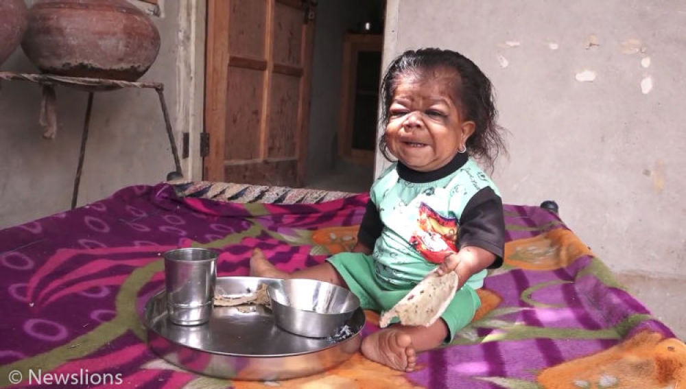 Hombre en la India que vive atrapado en el cuerpo de un bebe