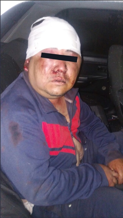 Intento de linchamiento en Toluca deja 22 heridos y vehículos quemados
