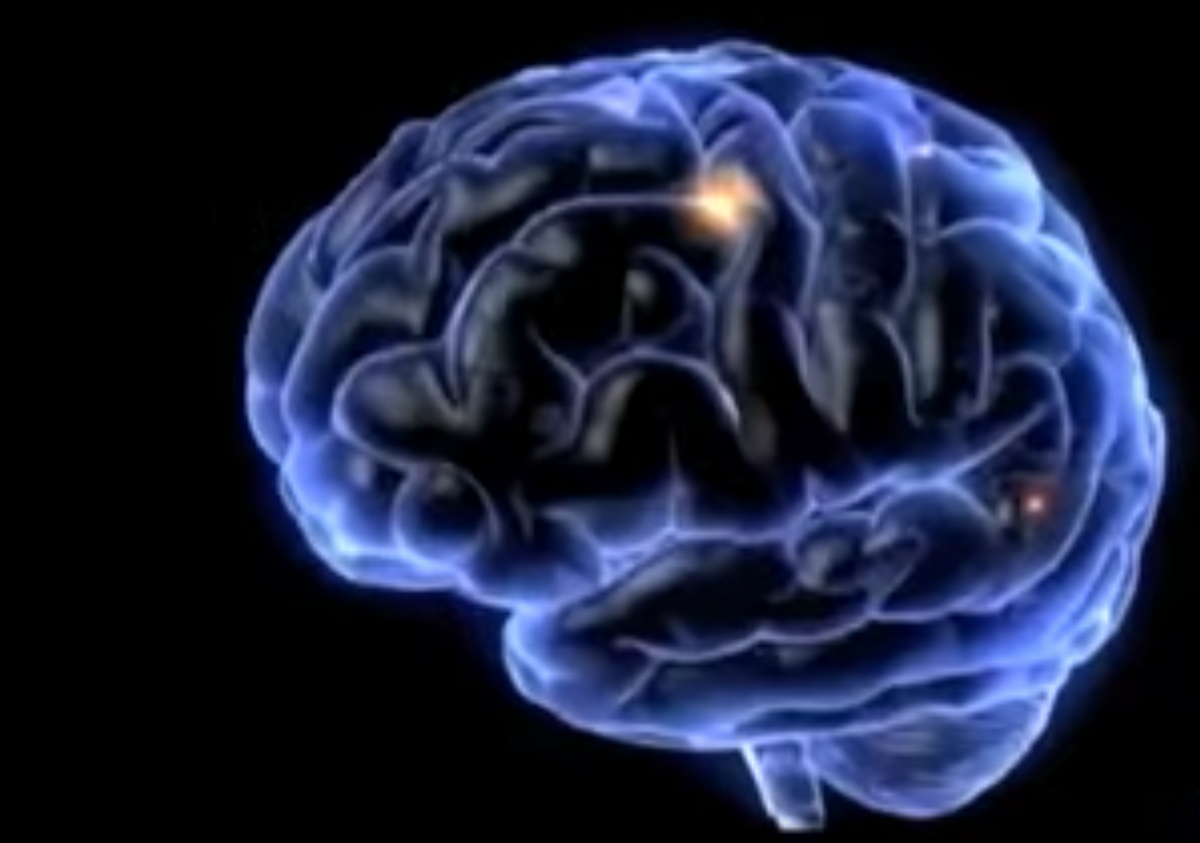 El cerebro sigue consciente después de la muerte, según investigadores