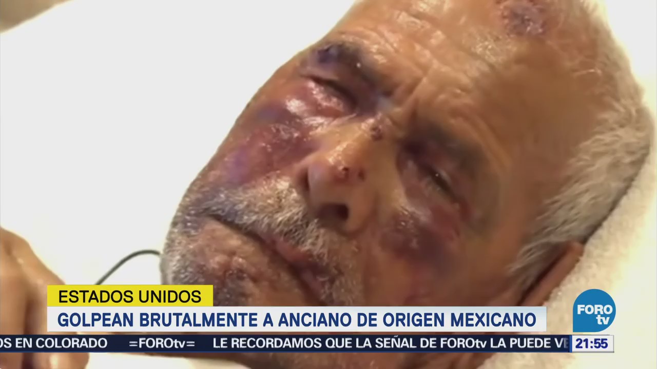 mujer golpeó a un hombre de origen mexicano