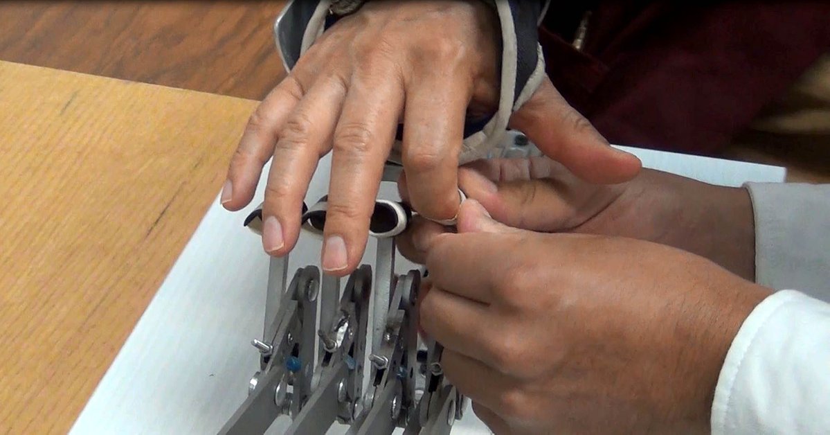 Rehabilitan dedos de la mano con tecnología creada por el IPN