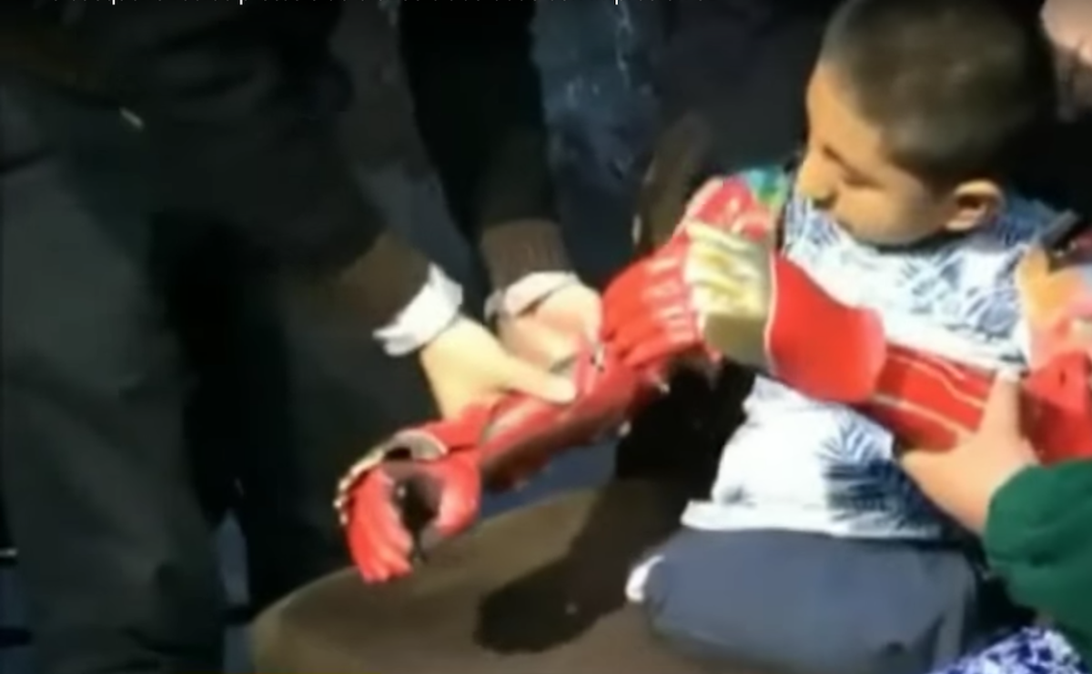 VIDEO: Niño recibe prótesis de brazos elaboradas con impresora 3D