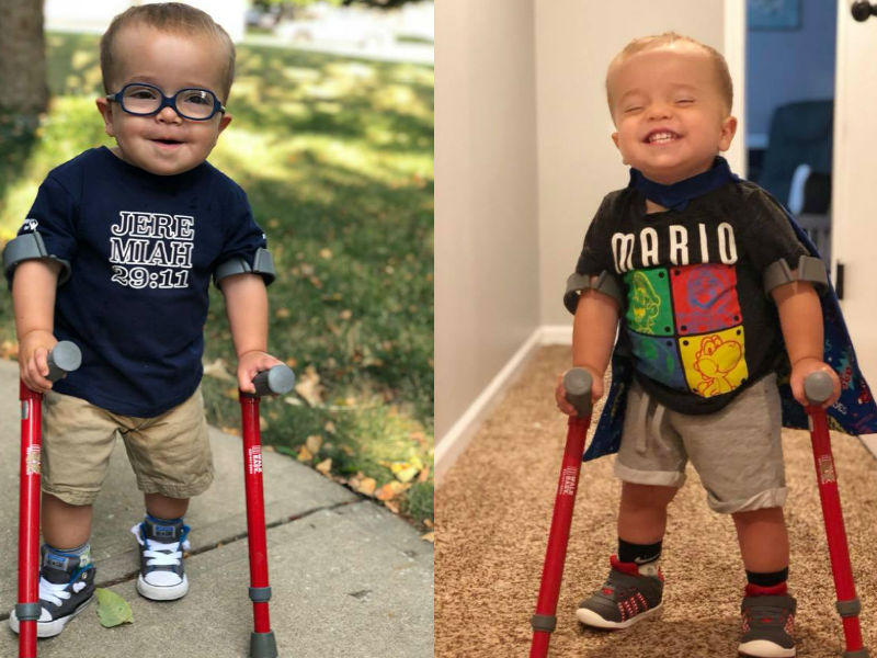 Niño dos años espina bífida logra caminar inspira mundo