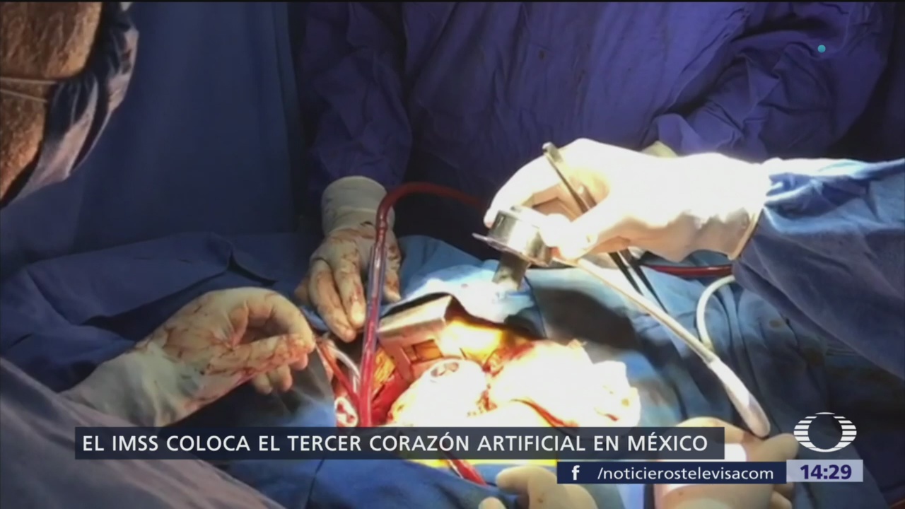 Médicos del IMSS colocan corazón artificial