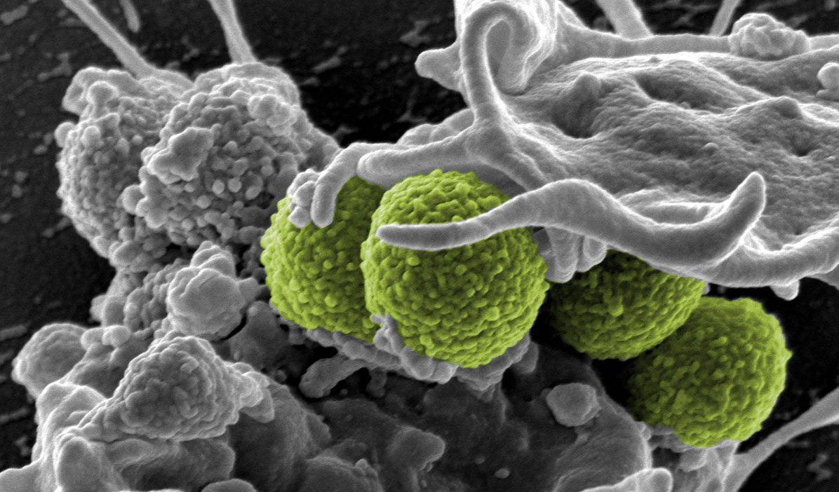 Desarrollan antibiótico contra las 'superbacterias'