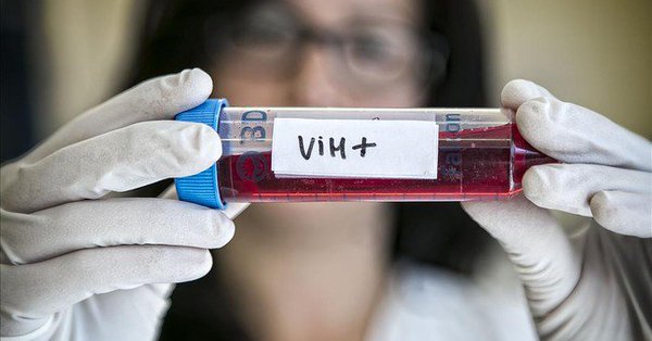 Reducen a niveles no detectables el virus del VIH con trasplantes de células madre