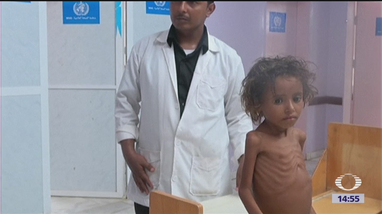 Miles de niños mueren de hambre en Yemen