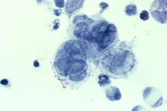 El virus del herpes visto desde un microscopio y pigmentado en color azul (Live Science)