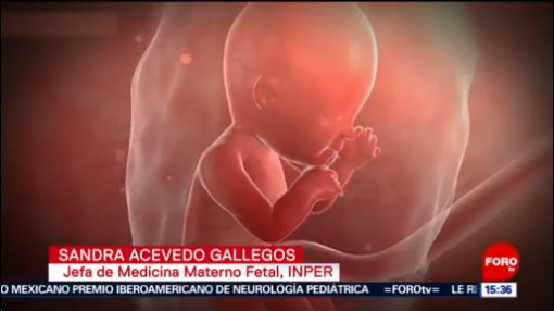 Placenta Puede Determinar El Curso Del Embarazo, Placenta, Doctora, Diane Pérez, Salud De La Madre E Hijo En El Embarazo, Embarazo