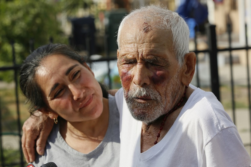 Foto: Aurelia Rodríguez (izquierda) sostiene a su padre, Rodolfo Rodríguez, de 92 años, víctima de una mujer que lo golpeó con un ladrillo en Willowbrook, Los Angeles, EEUU, el 11 de julio de 2018