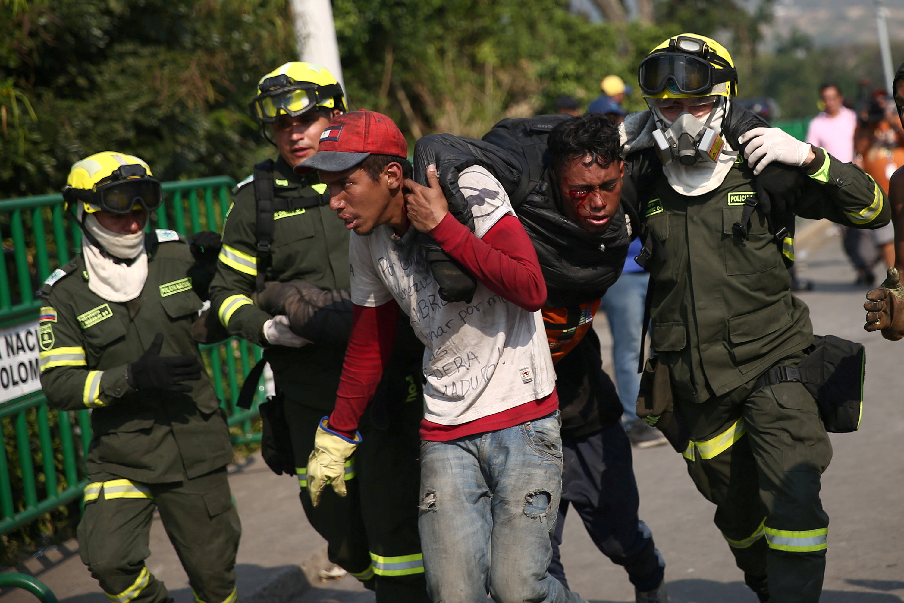 Foto: Una persona herida durante los enfrentamientos en el puente Simón Bolívar en la frontera entre Colombia y Venezuela, el 25 de febrero de 2019