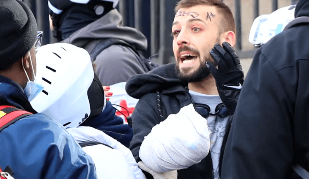 Foto: Hombre pierde mano en protestas en Francia, 9 de febrero 2019, Francia