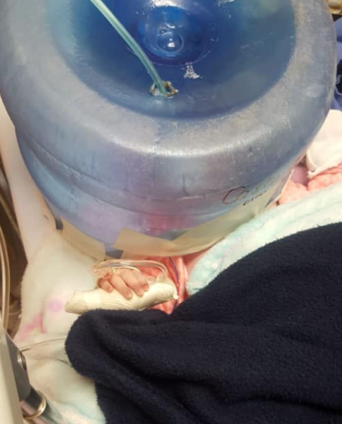 FOTO Hospital de Sonora usó garrafón como incubadora para bebé Facebook febrero 2019