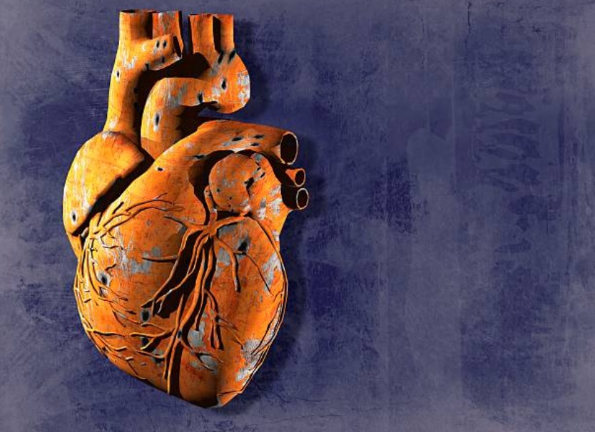 Seis causas que no sabíamos que pueden provocar un infarto