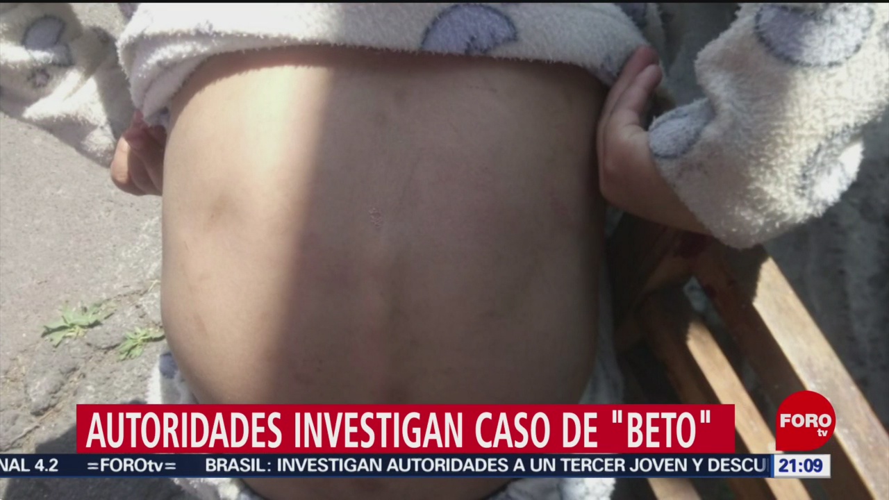 Foto: Beto Niño 6 Años Torturado Tlalpan CDMX 14 de Marzo 2019