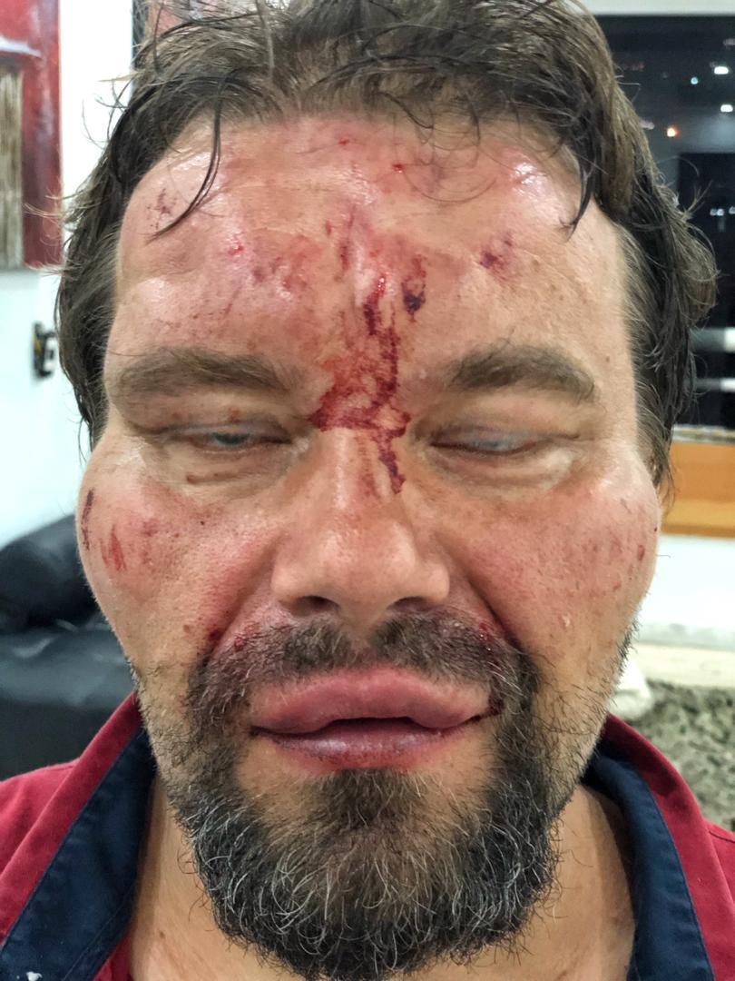 Foto: Tomasz Surdel, periodista polaco del diario Gazeta Wyborcza, fue agredido a golpes en calles de Caracas, Venezuela. El 15 de marzo del 2019