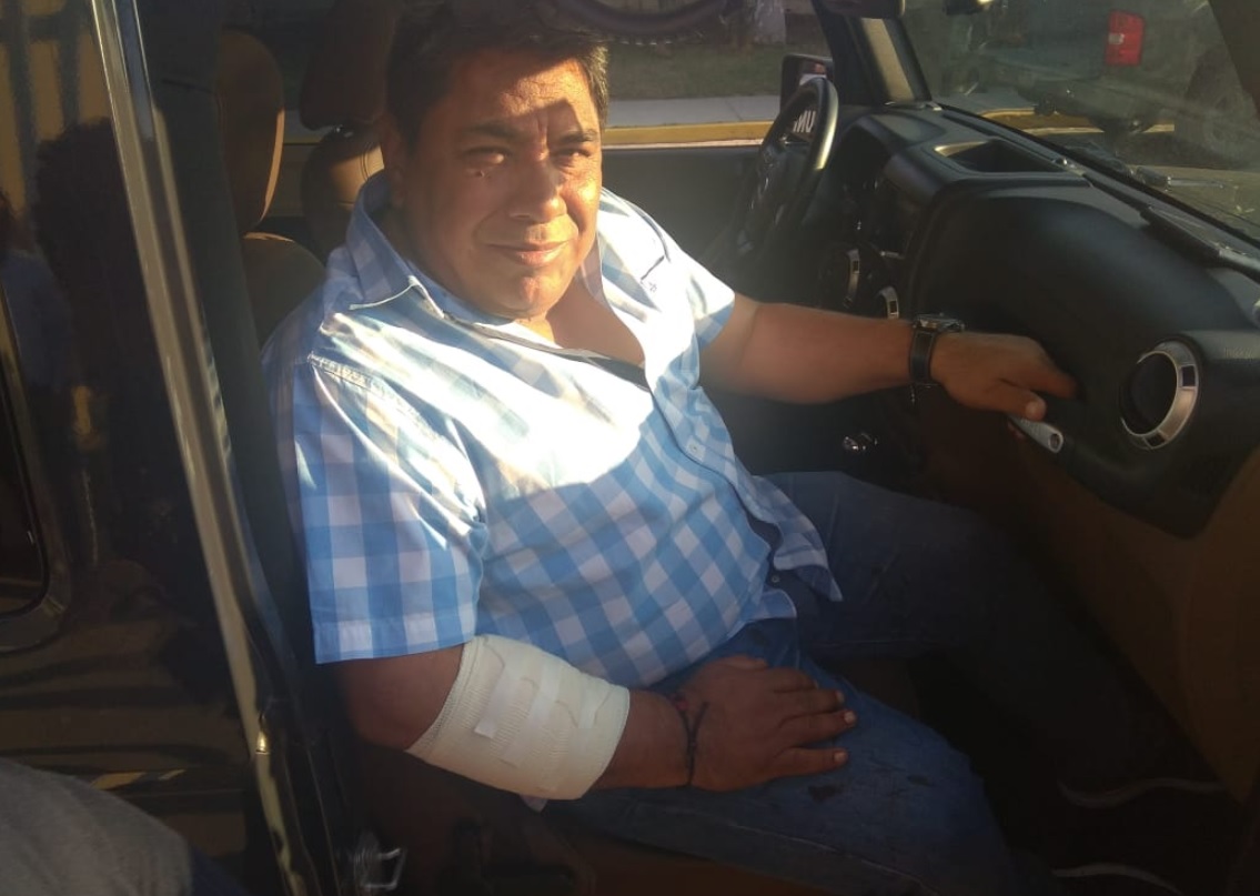 Periodista Hiram Moreno sobrevive a atentado en Salina Cruz, Oaxaca